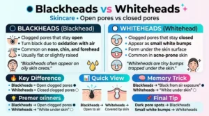 difference between blackheads and whiteheads